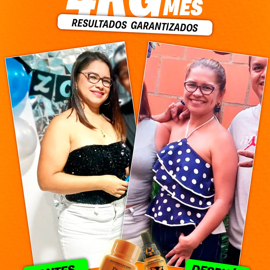 🔥 KE‑MA 🔥 QUEMADOR + DRENADOR NATURAL 💧💊